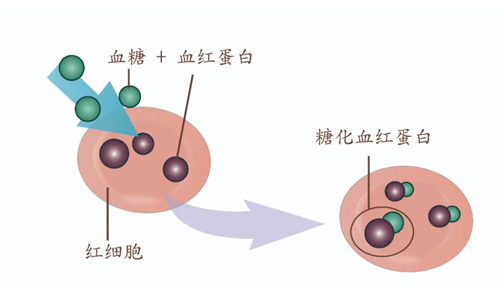 HbA1c≥6.5%——糖尿病诊断新标准